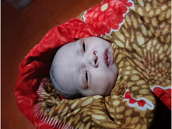 Metges sense fronteres beb recien nacido 2022 en Bangladesh