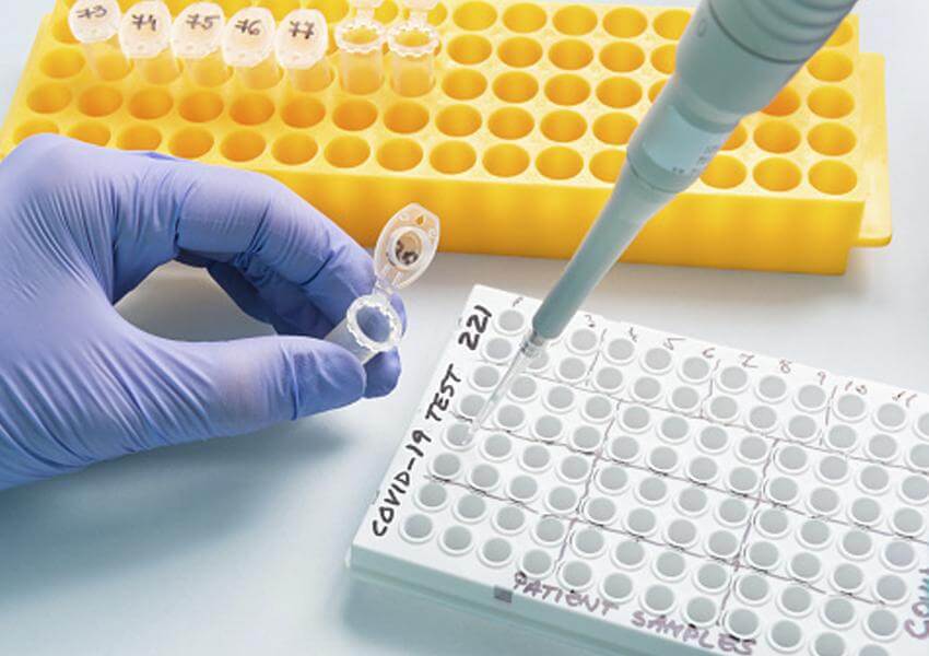 metges de catalunya covid test