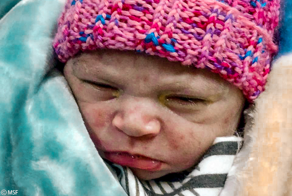 Medicos sin fronteras Afganistan Asma